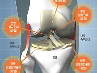 전방십자인대 재건술