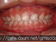 공주 미소담 치과..