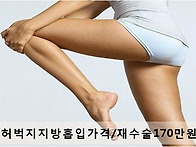 허벅지지방흡입가격 알아보..