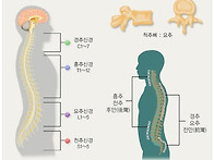 추간판탈출증 국가유공자 ..