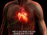 심혈관 문제