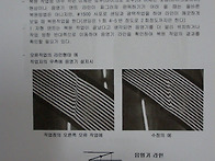-자덴트 복원이해 5