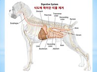 식도에 꽉끼인 이물 제거(내시경)