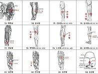 사혈요법 108혈자..