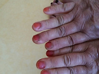 봉숭아 물 들이기