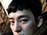 남자 눈성형한지 벌써 3달..