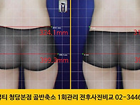 #골반관리 잘 하는 골근위..