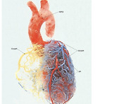 심혈관과 뇌혈관 청소