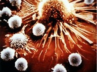 암을 극복하는 자연요법의..