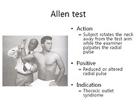 Allen test