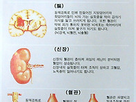 심혈관과 뇌혈관 청소