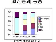 EECP와 협심증-웰..