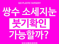 쌍수 소세지눈 재수술 붓기..