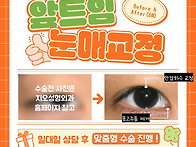 안검하수수술잘하는병원에..