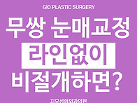 무쌍 안검하수 효과, 비절..
