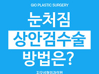 눈처짐 심해져서 상안검수..