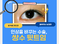 쌍수 뒷트임, 눈성형잘하는..