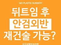 뒤트임 안검외반, 재건술로..