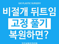 비절개 뒷트임 후 뒤트임 ..