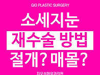 소세지눈 재수술 라인 낮출..