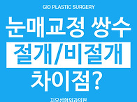 눈매교정 쌍수, 절개 비절..