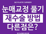 눈매교정 풀기 과교정 재수..