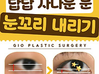 연예인 뒤트임 + 눈꼬리내..