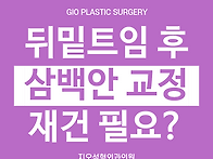 뒤밑트임 후 삼백안 교정하..