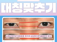 남자 눈재수술, 쌍수 짝짝..