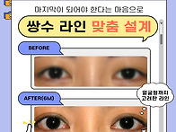 인라인 에서 아웃라인 쌍꺼..