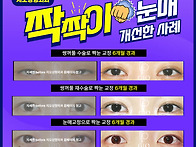 짝눈재수술 꼭 양쪽 다 해..