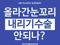 뒷트임 후기 : 눈꼬리 내..