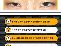 비대칭 안검하수 생기는 ..