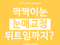 눈매교정 뒤트임, 짝짝이눈..