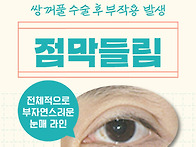 쌍수 후 점막 들림 재수술..
