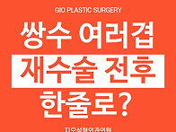 쌍꺼풀 여러겹, 재수술 전..