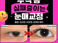 안검하수수술비용, 부작용..