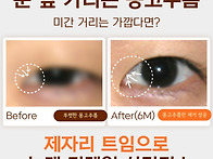 제자리트임 가격, 내 눈에..