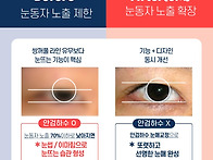 남자 눈매교정 후기, 여자..