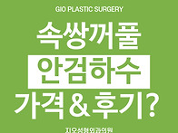 속쌍 안검하수 후기랑 가격..