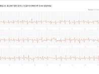 시술 2달후 재발 했습니다