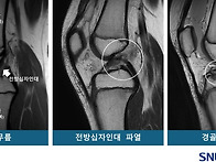[김태열의 생생건..