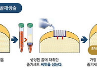 [Dr. 박의현의 발..