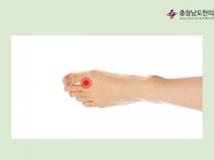 합곡혈(合谷穴) - 심장마비..