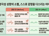 감정 조절 불가로 양극성 ..