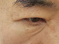 사고 6일차 실밥제..