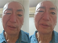 &lsquo;8혼&rsquo; 유퉁, &ldquo;한쪽 눈..