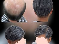 경주백모맞춤가발