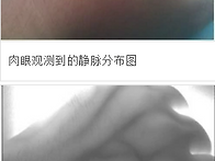 중국에서 발명한 '혈관 영..