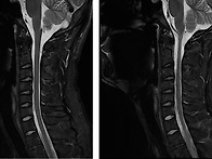 살고싶다 님의 경추, 흉추..